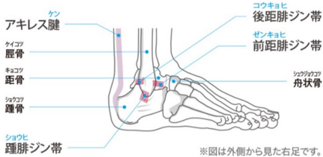 捻挫の原因